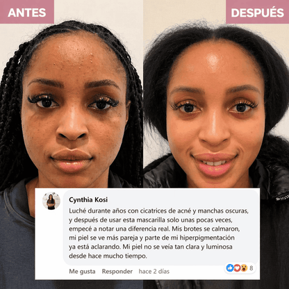 Mascarilla nocturna